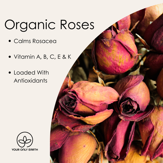 Roses-help-rosacea Only Earth